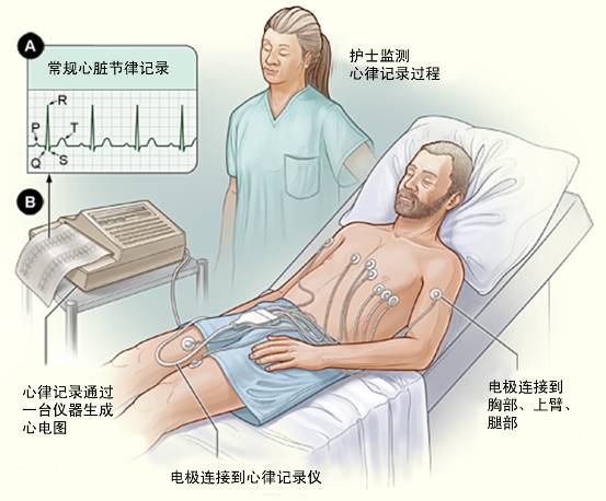 冠心病需要做哪些檢查？(圖1)