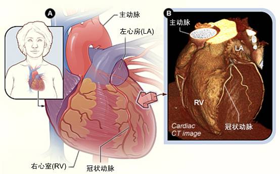 冠心病需要做哪些檢查？(圖2)